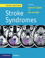 Stroke Syndromes 3rd Edition 2012