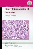 Biopsy Interpretation of the Breast  2/E 2013