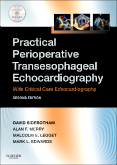Practical Perioperative Transesophageal Echocardiography, 2nd Edition  Text with DVD-ROM  2011