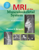 MRI of the Musculoskeletal System 6/E