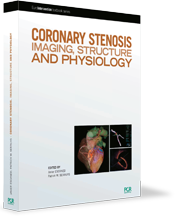 Coronary Stenosis IMAGING, STRUCTURE AND PHYSIOLOGY
