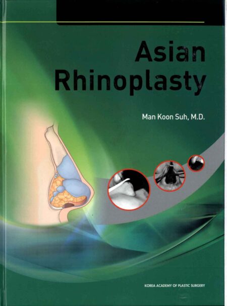Asian Rhinoplasty 2012