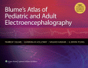 Blume's Atlas of Pediatric and Adult Electroencephalography