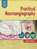 Practical Neuroangiography 3/E 2013