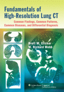 Fundamentals of High-Resolution Lung CT 2013