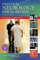 Practical Neurology Visual Review 2/E 2013