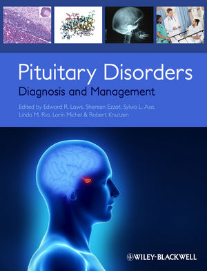 Pituitary Disorders: Diagnosis and Management 2013
