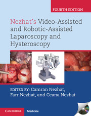 Nezhat's Video-Assisted and Robotic-Assisted Laparoscopy and Hysteroscopy 4/E 2013