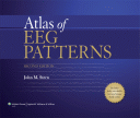 Atlas of EEG Patterns 2/E 2013