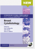 Breast Cytohistology Cytohistology of Small Tissue Samples Series