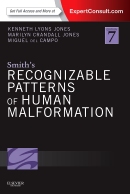 Smith's Recognizable Patterns of Human Malformation(Expert Consult - Online and Print) 7th Edition 2013