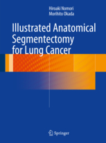 Illustrated Anatomical Segmentectomy for Lung Cancer 2013(平裝版)