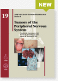 Afip 4/19 - Tumors of the Peripheral Nervous System