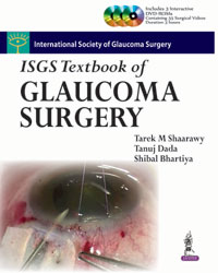 ISGS Textbook of Glaucoma Surgery (with DVD Roms)