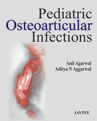 Pediatric Osteoarticular Infections 2013