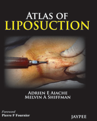 Atlas of Liposuction 2013(已絕版)
