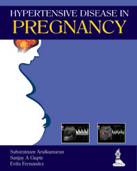 Hypertensive Disease in Pregnancy  2014