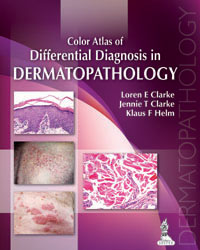 Color Atlas of Differential Diagnosis in Dermatopathology  2014