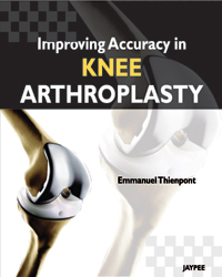 Improving Accuracy in Knee Arthoplasty 2012