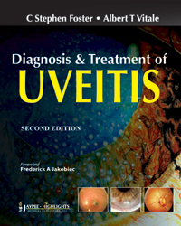 Diagnosis and Treatment of Uveitis2/E 2013