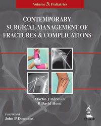 Contemporary Surgical Management of Fractures and Complications: Volume 3: Pediatrics  2014