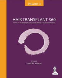 Hair Transplant 360: Advances, Techniques, Business Development, and Global Perspectives (Volume 3)  2014
