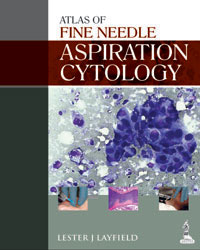 Colour Atlas of Ear Disease 2e