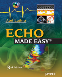 Echo Made Easy (with CD Rom) 2012