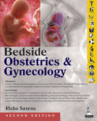 Bedside Obstetrics & Gynecology 2/E 2014