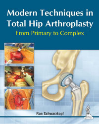 Modern Techniques in Total Hip Arthroplasty From Primary to Complex  2014