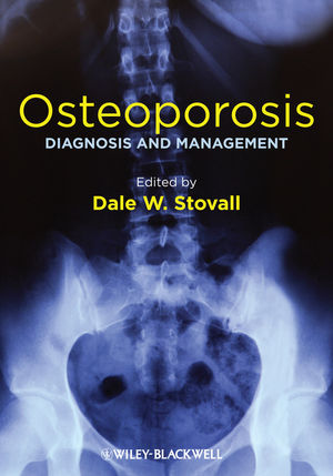 Osteoporosis: Diagnosis and Management 2014