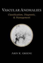 Vascular Anomalies: Classification, Diagnosis, and Management