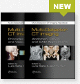 Multi-Detector CT Imaging Handbook Two Volume Set
