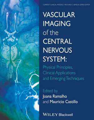 Vascular Imaging of the Central Nervous System: Physical Principles, Clinical Applications and Emerging Techniques 2014