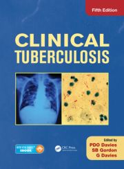 Clinical Tuberculosis, Fifth Edition 2014