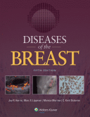 Diseases of the Breast 5e + Website 2014