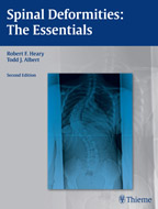 Spinal Deformities The Essentials