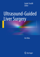 Ultrasound-Guided Liver Surgery: An Atlas  2014