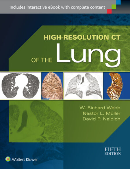 High-Resolution CT of the Lung 5/E(限量特價)