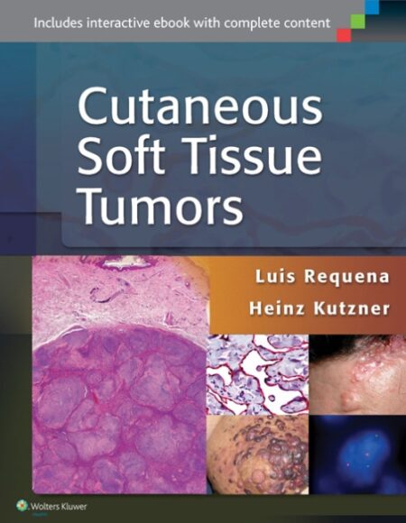 Cutaneous Soft Tissue Tumors 2015