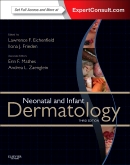 Neonatal and Infant Dermatology, 3rd Edition 2015