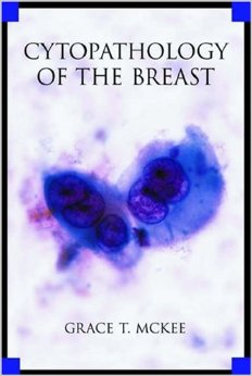 Cytopathology of the Breast with Imaging and Histologic Correlation