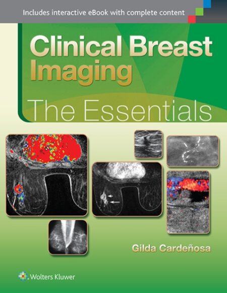 Clinical Breast Imaging: The Essentials  2015