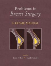 Problems in Breast Surgery: A Repair Manual + DVD