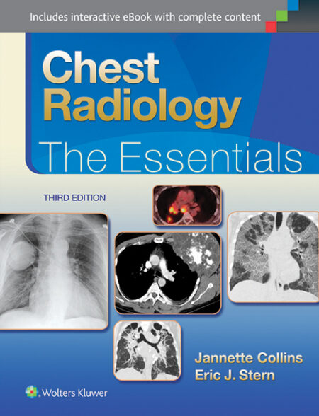 Chest Radiology: The Essentials 3/E 2015