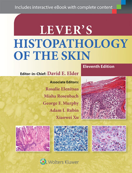 Lever's Histopathology of the Skin 11/E 2015