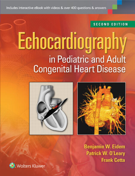 Echocardiography in Pediatric and Adult Congenital Heart Disease 2/E 2015