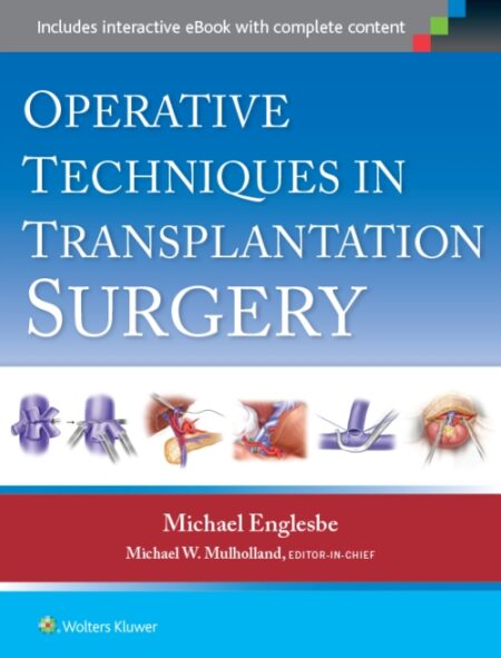 Operative Techniques in Transplantation Surgery 2015