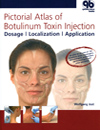 Illustrated Guide to Aesthetic Botulinumtoxin Injections: Basics, Localization, Uses
