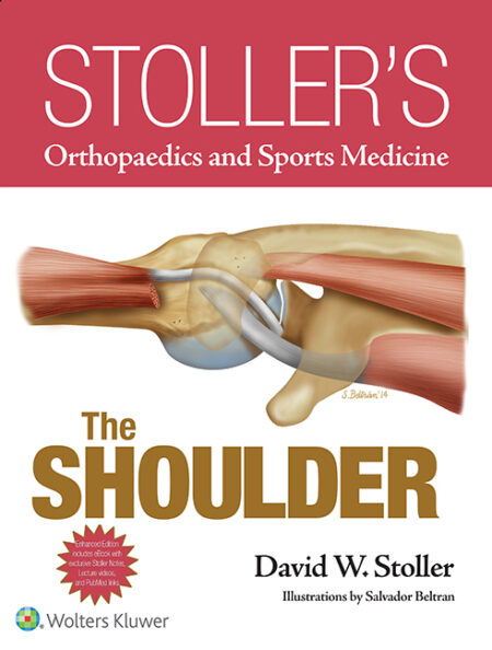 Stoller's Orthopaedics and Sports Medicine:The Shoulder Package (Print Edition Packaged with Stoller Lecture Videos)2015